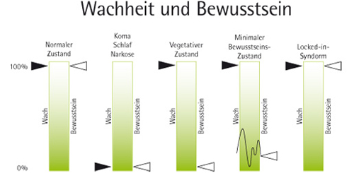 Wachheit und Bewusstsein Infografik